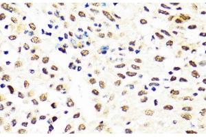 Immunohistochemistry (Paraffin-embedded Sections) (IHC (p)) image for anti-TIA1 Cytotoxic Granule-Associated RNA Binding Protein (TIA1) antibody (ABIN7262058)