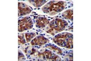 Formalin fixed and paraffin embedded human stomach tissue reacted with ABHD9 Antibody (C-term) followed by peroxidase conjugation of the secondary antibody and DAB staining. (ABHD9 Antikörper  (C-Term))