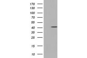 HEK293T cells were transfected with the pCMV6-ENTRY control (Left lane) or pCMV6-ENTRY CBWD1 (Right lane) cDNA for 48 hrs and lysed. (CBWD1 Antikörper)