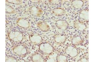 Immunohistochemistry (IHC) image for anti-DnaJ (Hsp40) Homolog, Subfamily B, Member 8 (DNAJB8) (AA 1-232) antibody (ABIN7150532)