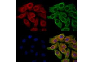 ABIN6265094 and ABIN6278291 staining Hela cells by IF/ICC.
