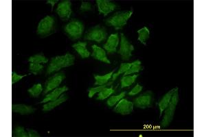 Immunofluorescence of monoclonal antibody to RAB9A on HeLa cell. (RAB9A Antikörper  (AA 17-115))