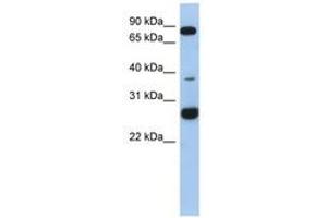 Image no. 1 for anti-Chromosome 1 Open Reading Frame 110 (C1ORF110) (AA 35-84) antibody (ABIN6743881) (C1ORF110 Antikörper  (AA 35-84))