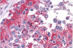 Immunohistochemistry (IHC) image for anti-Catechol-O-Methyltransferase (COMT) (Internal Region) antibody (ABIN185682)