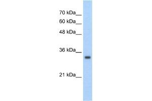 WB Suggested Anti-ZNF227 Antibody Titration:  2. (ZNF227 Antikörper  (Middle Region))
