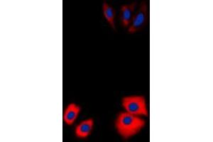 Immunofluorescent analysis of MARK2 staining in Jurkat cells. (MARK2 Antikörper  (N-Term))