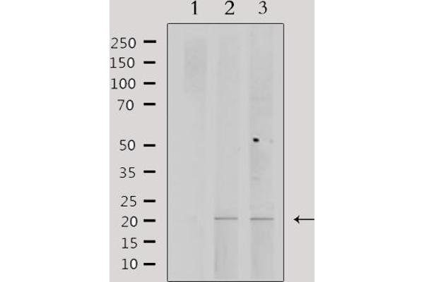 PPP1R14C Antikörper  (Internal Region)