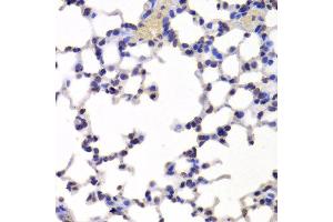 Immunohistochemistry of paraffin-embedded Mouse lung using INTS6 antibody at dilution of 1:100 (x400 lens). (INTS6 Antikörper)