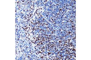 Immunohistochemistry of paraffin-embedded mouse spleen using Acetyl-Histone H2B-K5 antibody (ABIN7267733) at dilution of 1:100 (40x lens).