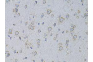 Immunohistochemistry of paraffin-embedded rat brain using GARS antibody (ABIN5973156) at dilution of 1/100 (40x lens). (GARS Antikörper)