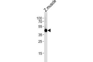Western Blotting (WB) image for anti-Interferon Regulatory Factor 2 Binding Protein 2 (IRF2BP2) antibody (ABIN3004746) (IRF2BP2 Antikörper)