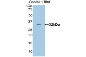 Western blot analysis of the recombinant protein. (GPI Antikörper  (AA 308-558))