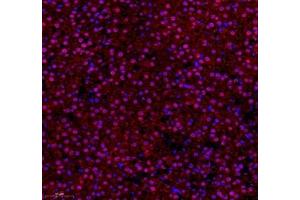 Immunofluorescence of paraffin embedded rat adrenal gland using ZNF295 (ABIN7076264) at dilution of 1: 650 (250x lens) (ZNF295 Antikörper)