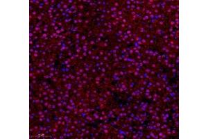 Immunofluorescence of paraffin embedded rat adrenal gland using ZNF295 (ABIN7076264) at dilution of 1: 650 (250x lens)