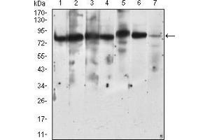 Western Blotting (WB) image for anti-Ribosomal Protein S6 Kinase, 90kDa, Polypeptide 2 (RPS6KA2) (AA 415-734) antibody (ABIN5542368)