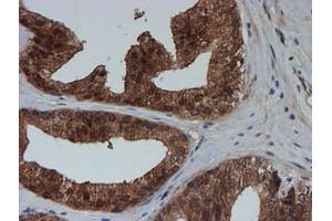 Image no. 12 for anti-Spermidine/Spermine N1-Acetyltransferase 2 (SAT2) antibody (ABIN1500807)