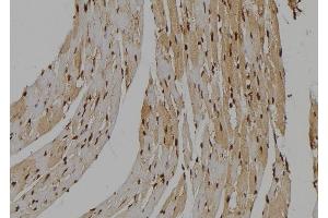 ABIN6263656 and ABIN6277487 at 1/100 staining Mouse heart tissue by IHC-P.