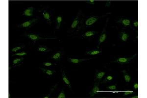 Immunofluorescence of monoclonal antibody to DIDO1 on HeLa cell. (DIDO1 Antikörper  (AA 321-420))