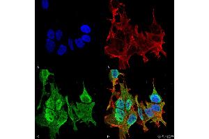 Immunocytochemistry/Immunofluorescence analysis using Mouse Anti-Ankyrin B Monoclonal Antibody, Clone S105-13 . (ANK2 Antikörper  (AA 203-496) (Atto 594))