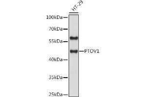 Western blot analysis of extracts of HT-29 cells, using PTOV1 antibody (ABIN7269578) at 1:1000 dilution. (PTOV1 Antikörper  (AA 1-100))