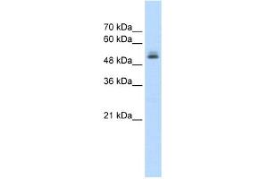 WB Suggested Anti-PRPF19 Antibody Titration:  1. (PRP19 Antikörper  (N-Term))