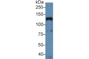 Western Blot; Sample: Human Hela cell lysate; Primary Ab: 5µg/ml Rabbit Anti-Human NUP133 Antibody Second Ab: 0. (NUP133 Antikörper  (AA 899-1091))