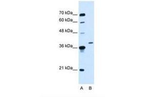 Image no. 1 for anti-Homeobox D11 (HOXD11) (AA 177-226) antibody (ABIN6737663) (HOXD11 Antikörper  (AA 177-226))
