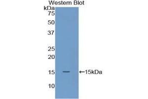 Detection of Recombinant S100A9, Mouse using Polyclonal Antibody to S100 Calcium Binding Protein A9 (S100A9)