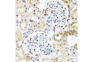 Immunohistochemistry (Paraffin-embedded Sections) (IHC (p)) image for anti-Polynucleotide Kinase 3'-Phosphatase (PNKP) (AA 60-320) antibody (ABIN6145836)