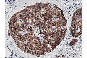 Image no. 3 for anti-Leucine Carboxyl Methyltransferase 1 (LCMT1) antibody (ABIN1499107) (LCMT1 Antikörper)