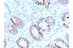 Immunohistochemistry (IHC) image for anti-C-Mer Proto-Oncogene Tyrosine Kinase (MERTK) (AA 55-148) antibody (ABIN6939061)