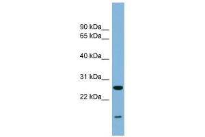 TRAPPC4 antibody used at 0. (TRAPPC4 Antikörper  (Middle Region))