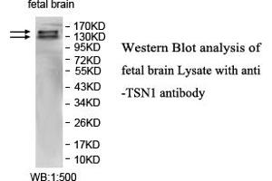 Image no. 1 for anti-Intersectin 1 (ITSN1) antibody (ABIN1577370) (ITSN1 Antikörper)