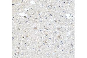 IHC analysis of STK24 using anti-STK24 antibody (ABIN7599389). (STK24 Antikörper  (AA 1-433))