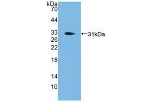 Detection of Recombinant PCSK1, Human using Polyclonal Antibody to Proprotein Convertase Subtilisin/Kexin Type 1 (PCSK1) (PCSK1 Antikörper  (AA 500-738))