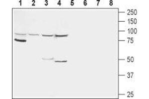 Western blot analysis of rat kidney (lanes 1 and 5), rat liver (lanes 2 and 6), mouse liver (lanes 3 and 7) and human HepG2 liver carcinoma cell line (lanes 4 and 8) lysates:  - 1-4. (Glucagon Receptor Antikörper  (1st Extracellular Loop))
