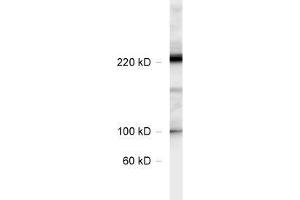 dilution: 1 : 1000, sample: rat hippocampus lysate (CACNA1B Antikörper  (AA 1921-2222))