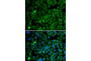 Immunofluorescence analysis of MCF-7 cells using SMYD4 antibody. (SMYD4 Antikörper  (AA 1-260))