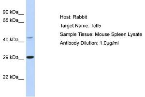Host: Rabbit Target Name: Tcfl5 Sample Type: Mouse Spleen lysates Antibody Dilution: 1. (TCFL5 Antikörper  (N-Term))