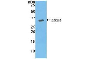 Detection of Recombinant ITGb1, Mouse using Polyclonal Antibody to Integrin Beta 1 (ITGb1) (ITGB1 Antikörper  (AA 454-714))