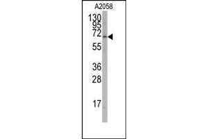 Image no. 1 for anti-RAR-Related Orphan Receptor A (RORA) antibody (ABIN356632) (RORA Antikörper)