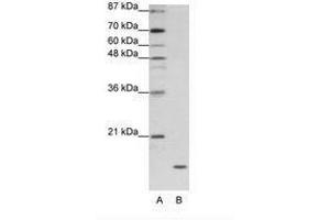 Image no. 1 for anti-Apolipoprotein O (APOO) (C-Term) antibody (ABIN202055) (APOO Antikörper  (C-Term))