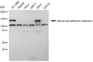 Western blotting analysis using Neural cell adhesion molecule 1 antibody (ABIN7799572). (Rekombinanter CD56 Antikörper)