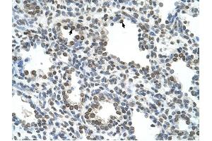 NKD1 antibody was used for immunohistochemistry at a concentration of 4-8 ug/ml to stain Alveolar cells (arrows) in Human Lung.