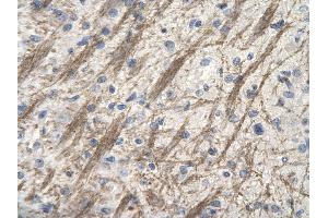 Rabbit Anti-ZNF74 antibody        Paraffin Embedded Tissue:  Human Brain cell   Cellular Data:  Epithelial cells of renal tubule  Antibody Concentration:   4.