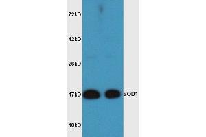 Mouse brain lysates probed with Rabbit Anti-SOD1 Polyclonal Antibody, Unconjugated  at 1:3000 for 90 min at 37˚C. (SOD1 Antikörper  (AA 6-100))