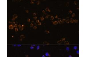 Immunofluorescence analysis of Jurkat cells using KLRC4 Polyclonal Antibody at dilution of 1:100 (40x lens). (KLRC4 Antikörper)