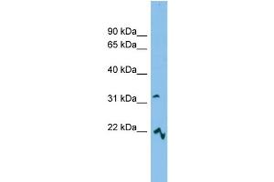 WB Suggested Anti-MCART6 Antibody Titration: 0. (MCART6 Antikörper  (Middle Region))