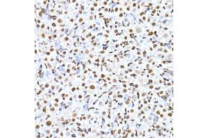 Immunohistochemistry of paraffin-embedded rat ovary using RBM3 Rabbit mAb (ABIN7270084) at dilution of 1:25 (40x lens). (RBM3 Antikörper)