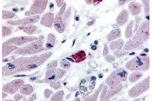 Immunohistochemistry (Formalin/PFA-fixed paraffin-embedded sections) of human macrophages tissue with EMR3 polyclonal antibody . (EMR3 Antikörper  (N-Term))